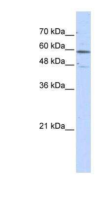 Western Blot: Glutamate Dehydrogenase 2/GLUD2 Antibody [NBP1-55437]