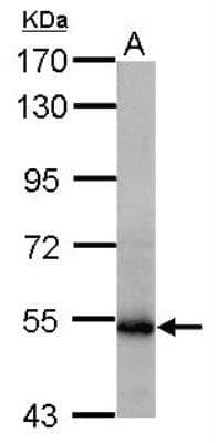 Western Blot: Glutamate Dehydrogenase 2/GLUD2 Antibody [NBP2-16678]