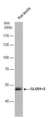 Western Blot: Glutamate Dehydrogenase 2/GLUD2 Antibody [NBP2-16678]