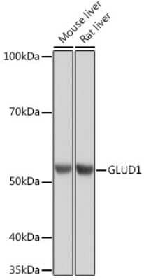 Western Blot: Glutamate Dehydrogenase Antibody (7L7N2) [NBP3-16582]