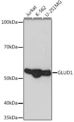 Western Blot: Glutamate Dehydrogenase Antibody (7L7N2) [NBP3-16582]