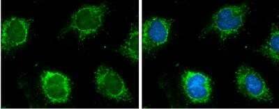 Immunocytochemistry/ Immunofluorescence: Glutamate Dehydrogenase Antibody [NBP2-16679]