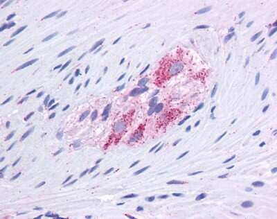Immunohistochemistry-Paraffin: Glutamate Dehydrogenase Antibody [NBP1-54961]