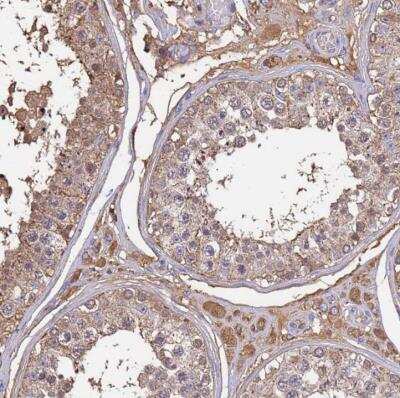 Immunohistochemistry-Paraffin: Glutamate Dehydrogenase Antibody [NBP2-54700]