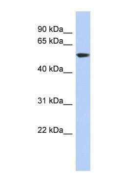 Western Blot: Glutamate Dehydrogenase Antibody [NBP1-54961]