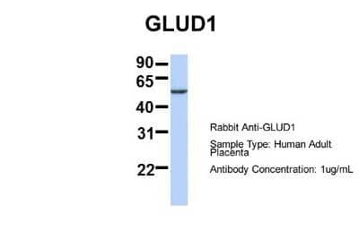 Western Blot: Glutamate Dehydrogenase Antibody [NBP1-54962]