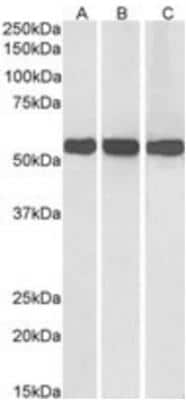 Western Blot: Glutamate Dehydrogenase Antibody [NBP1-68846]