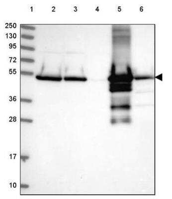 Western Blot: Glutamate Dehydrogenase Antibody [NBP2-54715]