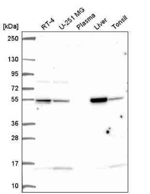 Western Blot: Glutamate Dehydrogenase Antibody [NBP2-57114]