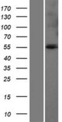 Western Blot: Glutamate Dehydrogenase Overexpression Lysate [NBP2-10478]