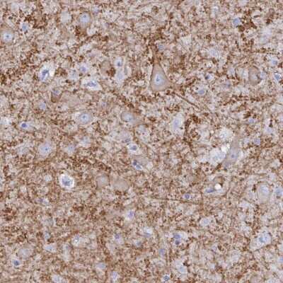 Immunohistochemistry-Paraffin: GluR1 Antibody [NBP2-33996]