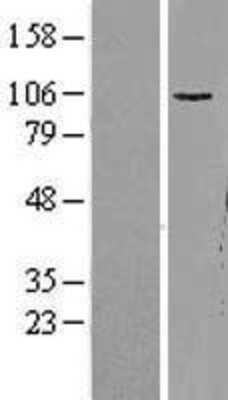 Western Blot: GluR1 Overexpression Lysate [NBL1-11335]