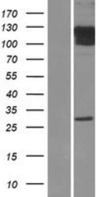 Western Blot: GluR1 Overexpression Lysate [NBP2-11406]