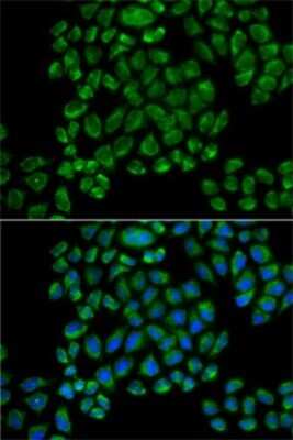 Immunocytochemistry/ Immunofluorescence: Glutamate Receptor 3 Antibody - BSA Free [NBP3-03557]