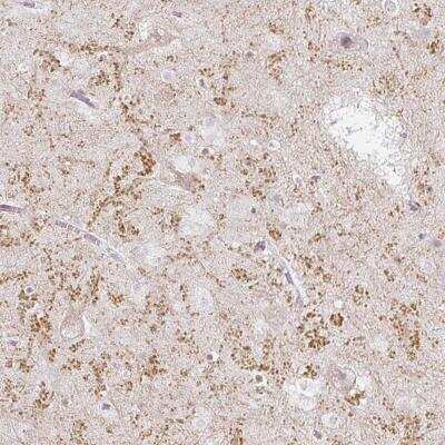 Immunohistochemistry-Paraffin: Glutamate Receptor 3 Antibody [NBP2-37972]