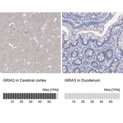 Immunohistochemistry-Paraffin: Glutamate Receptor 3 Antibody [NBP3-17081]