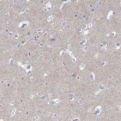 Immunohistochemistry-Paraffin: Glutamate Receptor 3 Antibody [NBP3-17081]