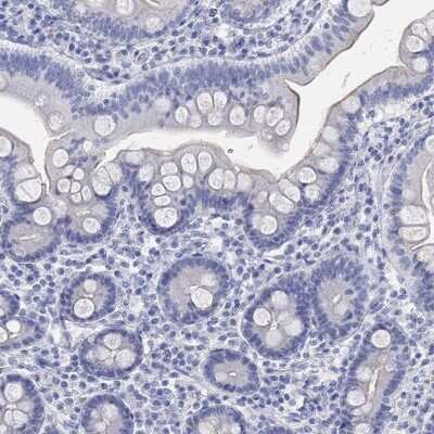 Immunohistochemistry-Paraffin: Glutamate Receptor 3 Antibody [NBP3-17081]