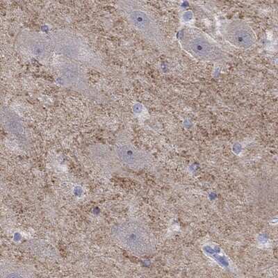 Immunohistochemistry-Paraffin: Glutamate Receptor 3 Antibody [NBP3-17081]