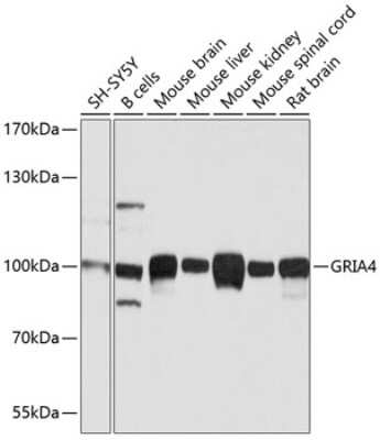 Western Blot: Glutamate Receptor 4 AntibodyBSA Free [NBP3-03617]