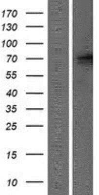 Western Blot: GluR5/GRIK1 Overexpression Lysate [NBP2-05058]