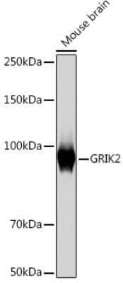 Western Blot: Glutamate Receptor 6 Antibody (4B4L9) [NBP3-16867]