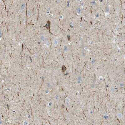 Immunohistochemistry-Paraffin: Glutamate Receptor 6 Antibody [NBP1-91945]