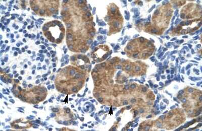 Immunohistochemistry: Glutamate Receptor 6 Antibody [NBP2-87510]