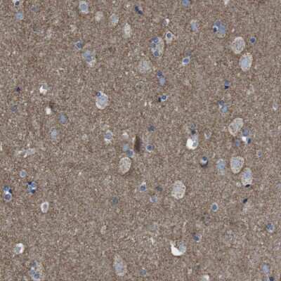 Immunohistochemistry-Paraffin: Glutamate Receptor 6 Antibody [NBP1-91946]