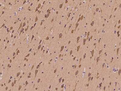 Immunohistochemistry-Paraffin: Glutamate Receptor 6 Antibody [NBP2-98590]