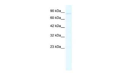 Western Blot: Glutamate Receptor 6 Antibody [NBP2-87508]