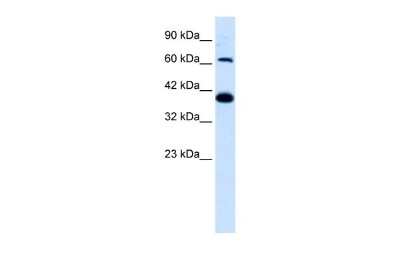 Western Blot: Glutamate Receptor 6 Antibody [NBP2-87510]