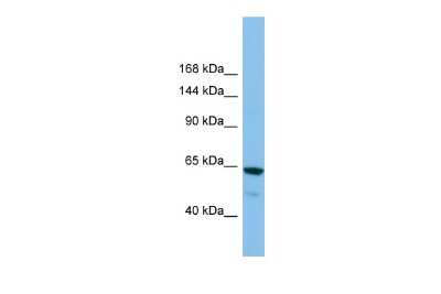 Western Blot: Glutamate Receptor 6 Antibody [NBP2-87511]