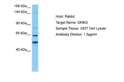 Western Blot: Glutamate Receptor 6 Antibody [NBP2-87512]