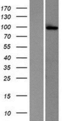 Western Blot: Glutamate Receptor 6 Overexpression Lysate [NBP2-05049]