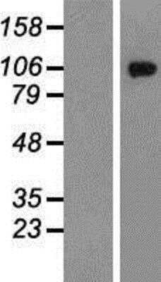 Western Blot: Glutamate Receptor 6 Overexpression Lysate [NBP2-06497]