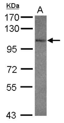 Western Blot: GluR7/GRIK3 Antibody [NBP2-16681]