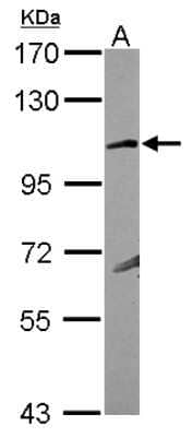 Western Blot: KA1/GRIK4/Glutamate Receptor KA1 Antibody [NBP2-16682]