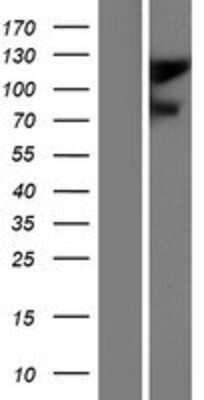 Western Blot: GluR2 Overexpression Lysate [NBP2-10653]