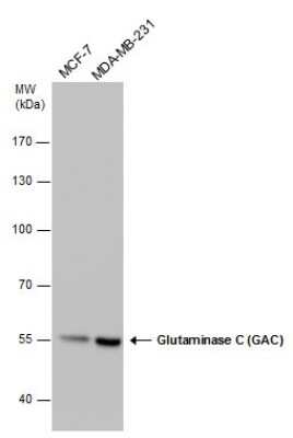 Western Blot: Glutaminase Antibody (3211) [NBP2-43762]