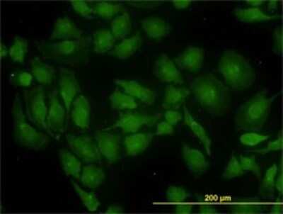 Immunocytochemistry/ Immunofluorescence: Glutaminase Antibody (5C4) [H00002744-M01]
