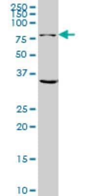 Western Blot: Glutaminase Antibody (5C4) [H00002744-M01]