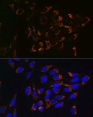 Immunocytochemistry/ Immunofluorescence: Glutaminase Antibody (8R8J6) [NBP3-15340]