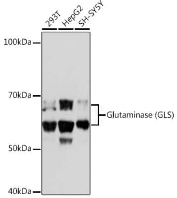 Western Blot: Glutaminase Antibody (8R8J6) [NBP3-15340]