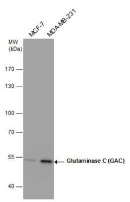 Western Blot: Glutaminase Antibody (GT1075) [NBP3-13512]