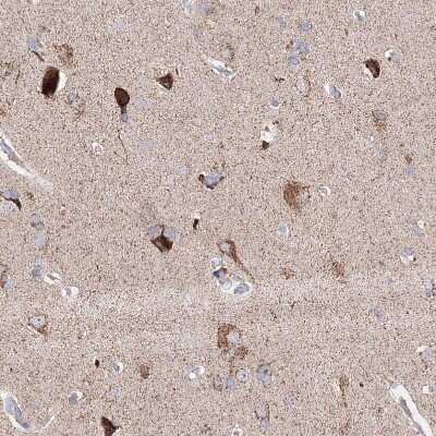 Immunohistochemistry-Paraffin: Glutaminase Antibody [NBP1-89766]