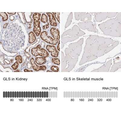 Immunohistochemistry-Paraffin: Glutaminase Antibody [NBP1-89766]