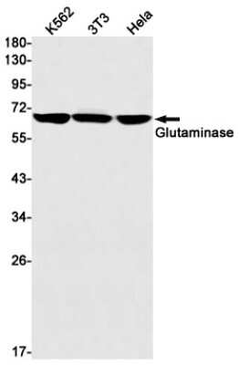 Western Blot: Glutaminase Antibody (S08-3D8) [NBP3-14937]