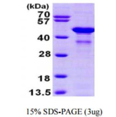 SDS-PAGE: Recombinant Human Glutamine Synthetase His Protein [NBP1-50841]