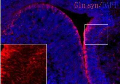 Immunohistochemistry-Frozen: Glutamine Synthetase Antibody (1055) [NBP2-43646]